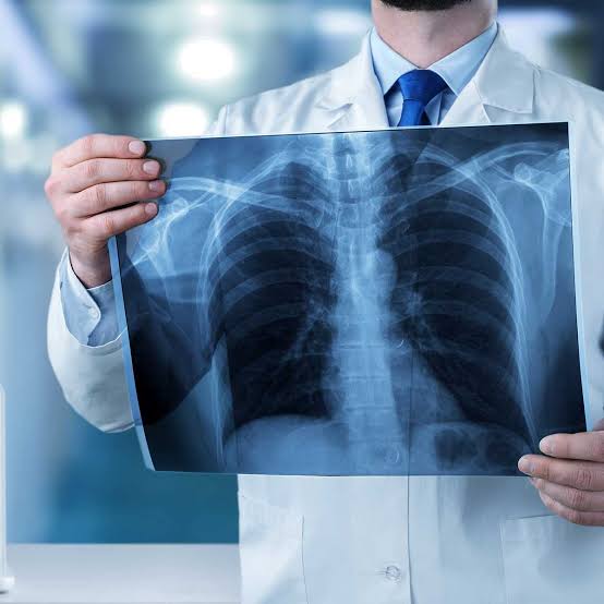 STUDY RADIOGRAPHY